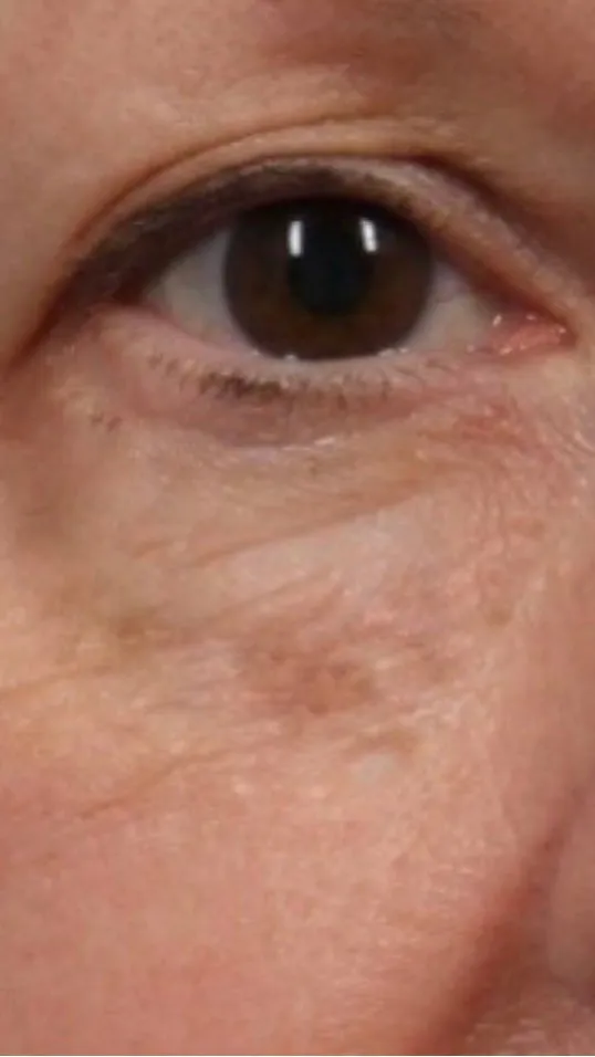 12th Night under eye serum